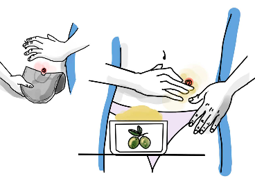 Ostomía digestiva, gel Aceite de Oliva